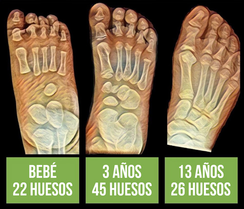 Etapas de formación de huesos en radiografías