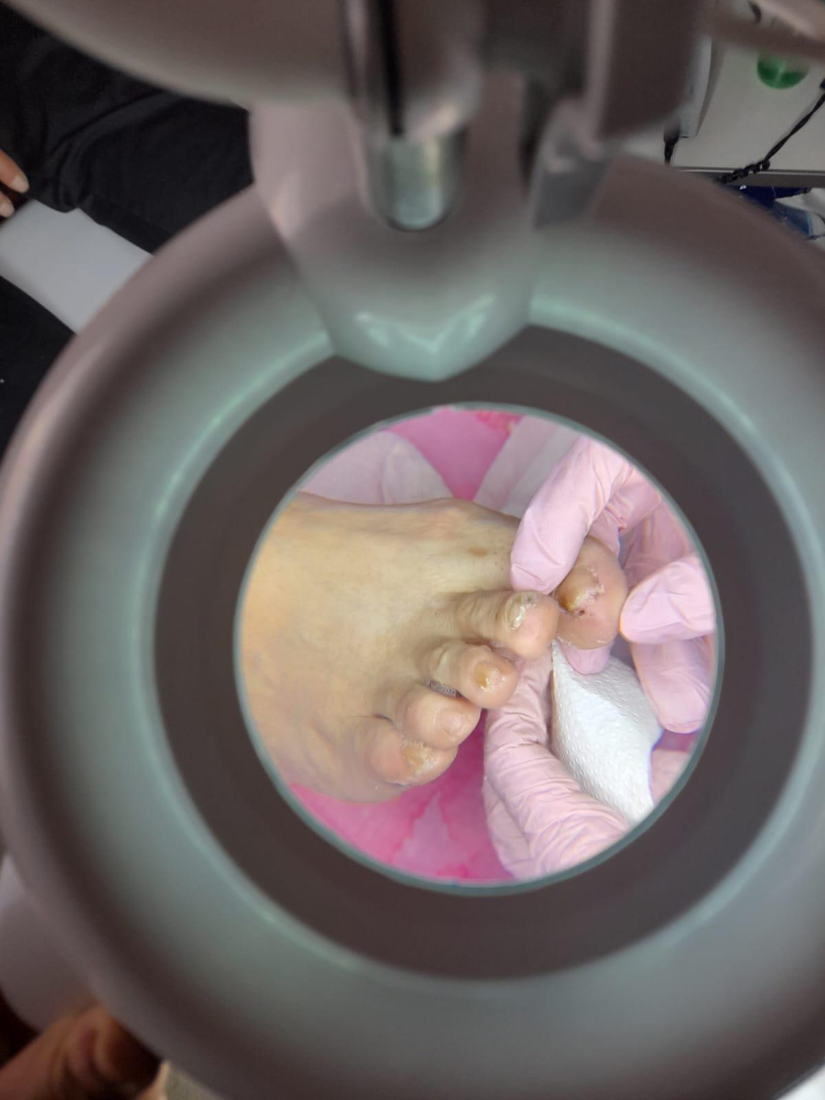 Detección Temprana - Podología La Plata