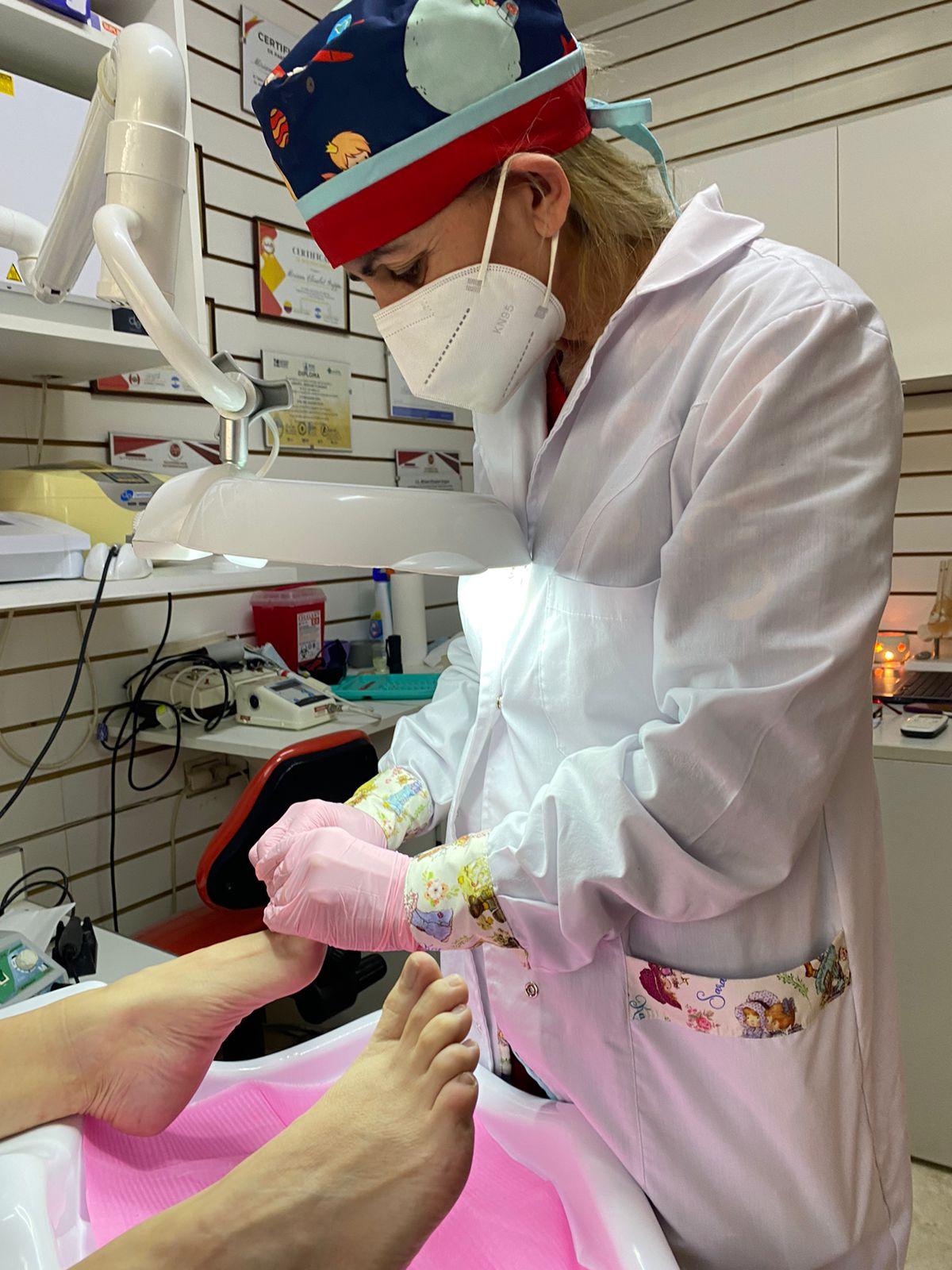 Onicocriptosis (Uñas Encarnadas) - Podología La Plata