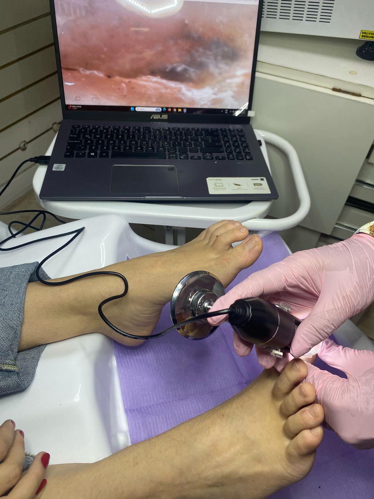 Onicospatia - Podología La Plata